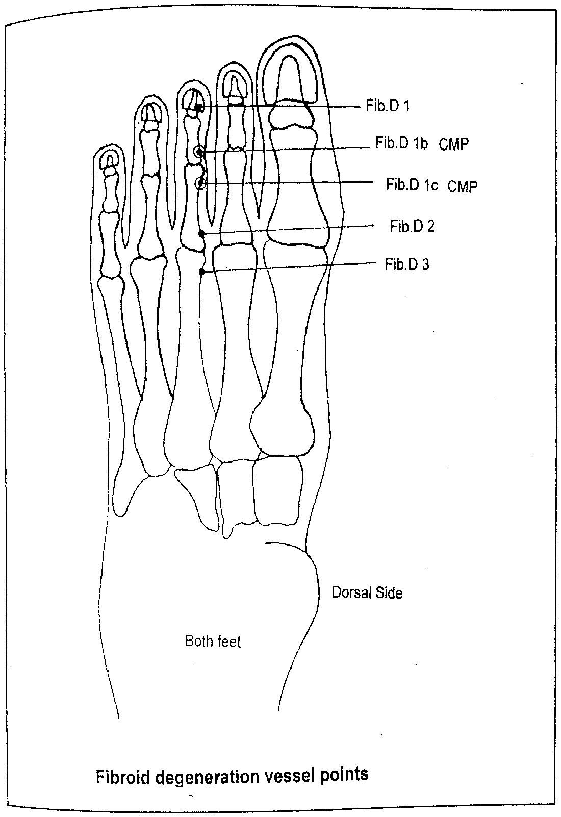 Diagram of the dorsal side of the foot showing Fibroid Degeneration Vessel points Fib.D1, Fib.D1b (CMP), Fib.D1c (CMP), Fib.D2 and Fib.D3