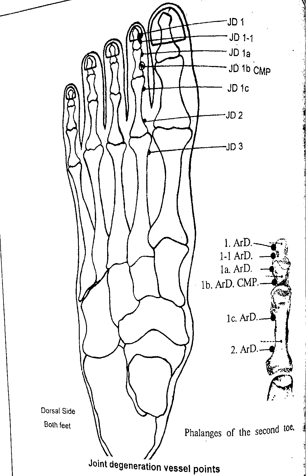Diagram of the dorsal side of the foot showing Joint Degeneration Vessel points JD1, JD1-1, JD1a, JD1b (CMP), JD1c, JD2 and JD3, with an inset detail of the phalanges of the second toe labelled ArD 1 through ArD 2