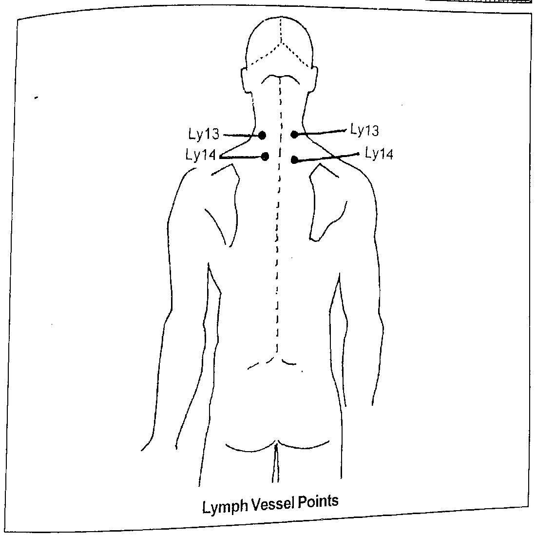 Diagram of the back of the neck and upper back showing Lymph Vessel points Ly13 and Ly14