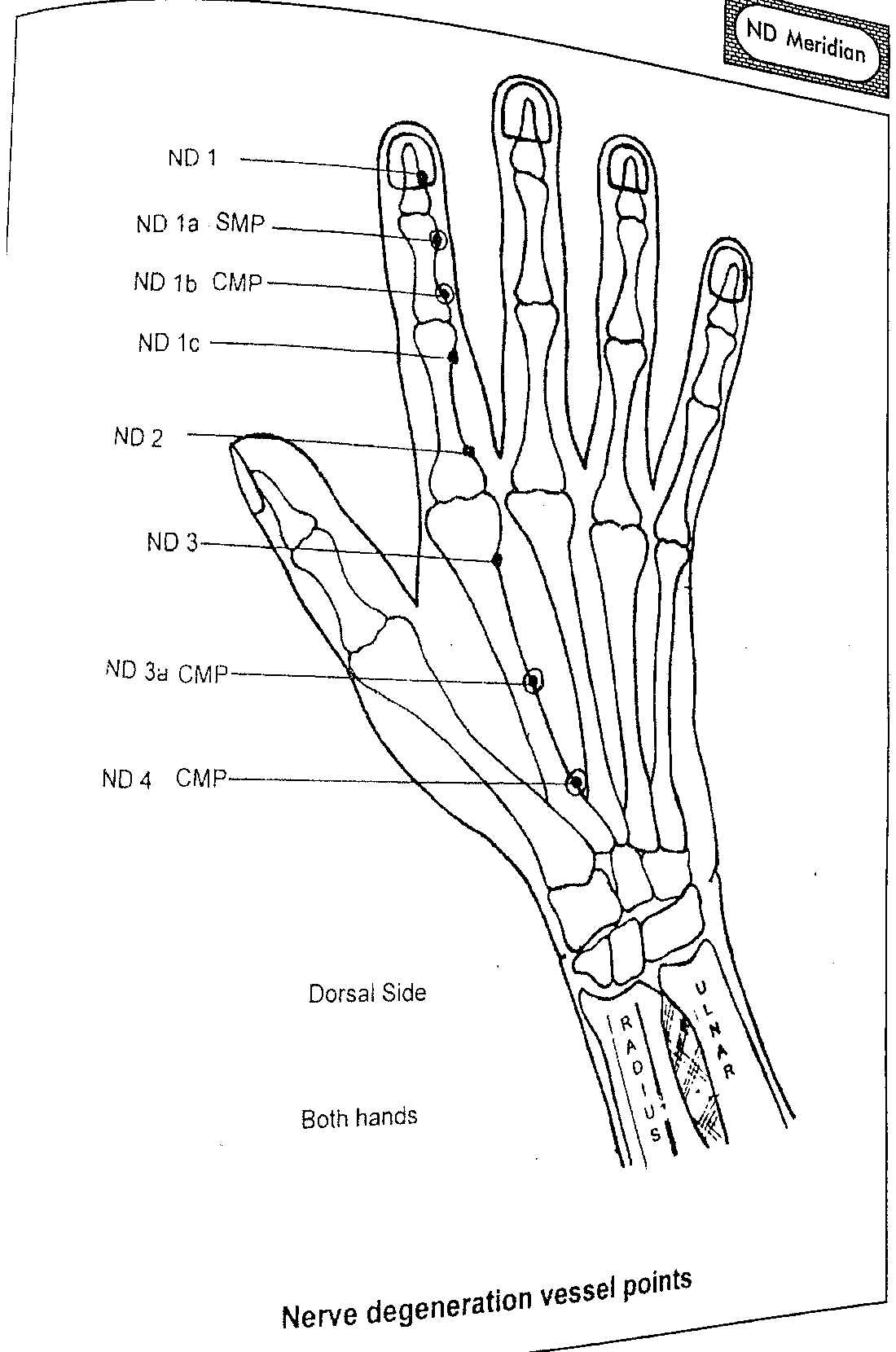 Diagram of the dorsal side of the hand showing Nerve Degeneration Vessel points ND1, ND1a (SMP), ND1b (CMP), ND1c, ND2, ND3, ND3a (CMP) and ND4 (CMP)